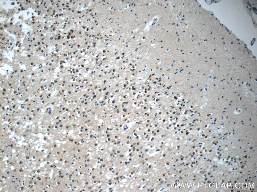 Immunohistochemistry (IHC) staining of human brain tissue using KIAA0087 Polyclonal antibody (24973-1-AP)