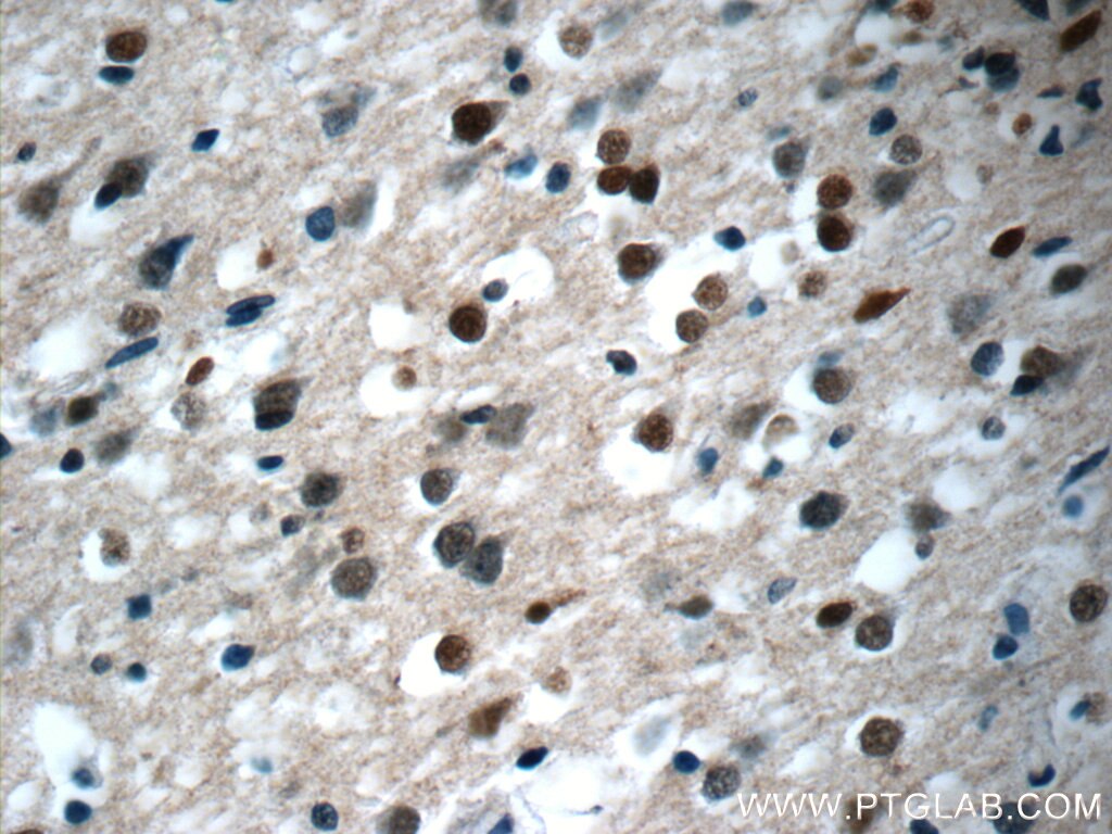 Immunohistochemistry (IHC) staining of human brain tissue using KIAA0087 Polyclonal antibody (24973-1-AP)