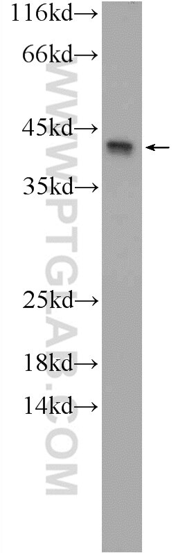 Western Blot (WB) analysis of SW 1990 cells using KIAA0087 Polyclonal antibody (24973-1-AP)