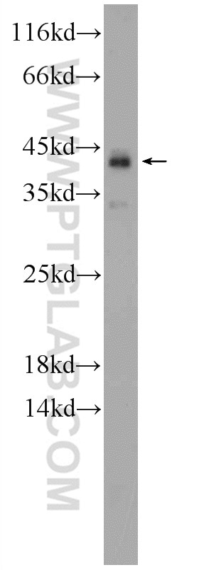 Western Blot (WB) analysis of fetal human brain tissue using KIAA0087 Polyclonal antibody (24973-1-AP)