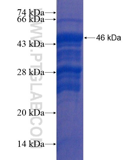 KIAA0087 fusion protein Ag21759 SDS-PAGE