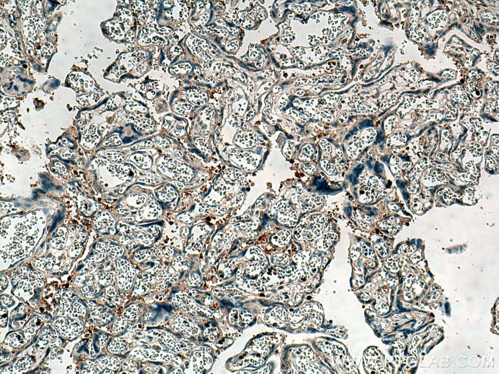 Immunohistochemistry (IHC) staining of human placenta tissue using KIAA0090 Polyclonal antibody (26017-1-AP)