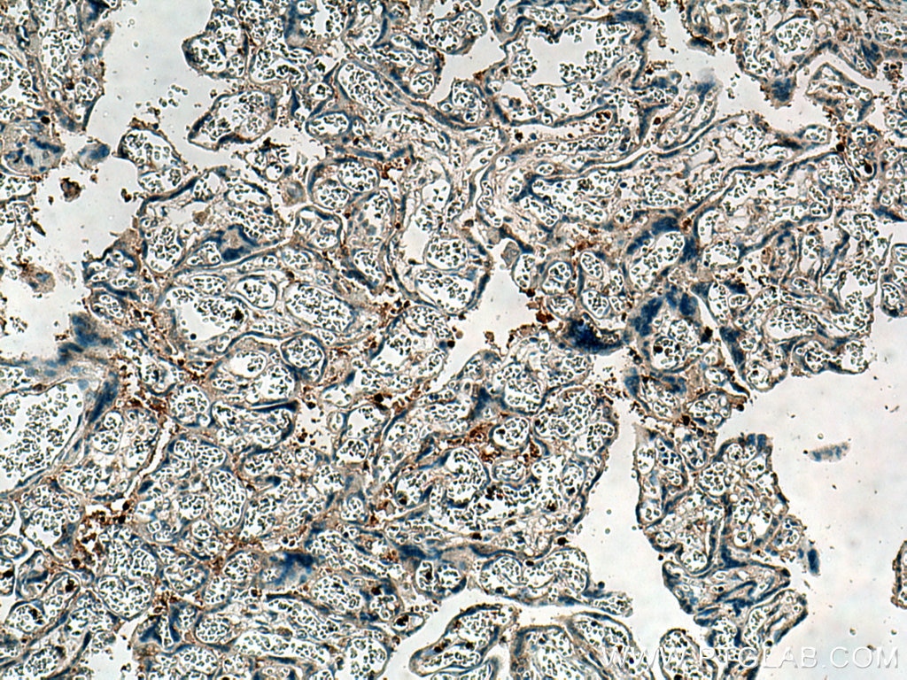 IHC staining of human placenta using 26017-1-AP