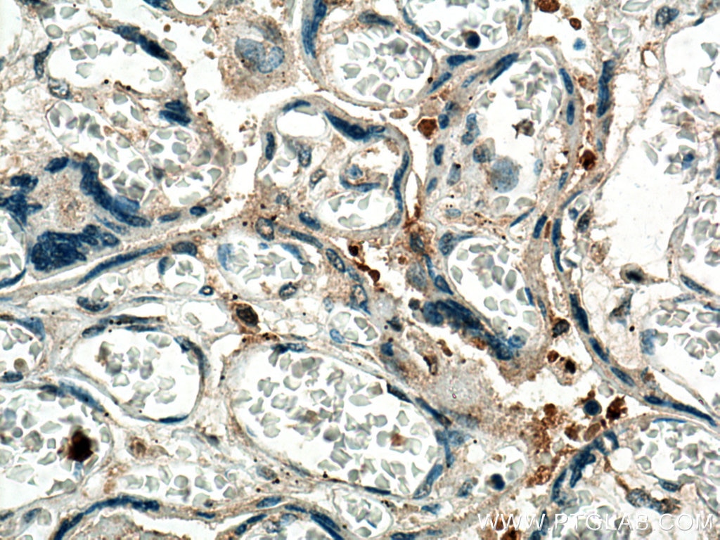 Immunohistochemistry (IHC) staining of human placenta tissue using KIAA0090 Polyclonal antibody (26017-1-AP)