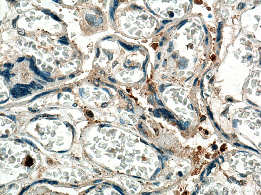 IHC staining of human placenta using 26017-1-AP