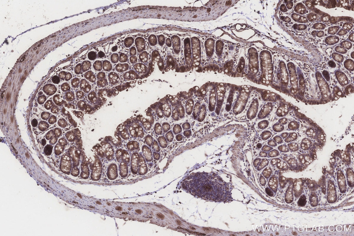 IHC staining of mouse colon using 26017-1-AP Immunohistochemistry (IHC) staining of mouse colon tissue using KIAA0090 Polyclonal antibody (26017-1-AP)