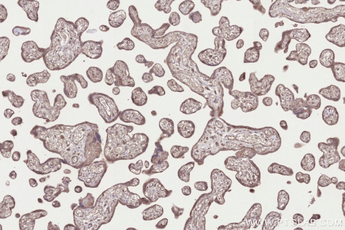IHC staining of human placenta using 26017-1-AP Immunohistochemistry (IHC) staining of human placenta tissue using KIAA0090 Polyclonal antibody (26017-1-AP)
