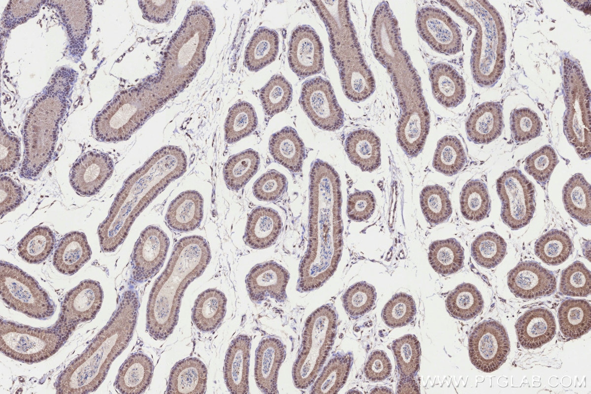 IHC staining of mouse epididymis using 26017-1-AP Immunohistochemistry (IHC) staining of mouse epididymis tissue using KIAA0090 Polyclonal antibody (26017-1-AP)