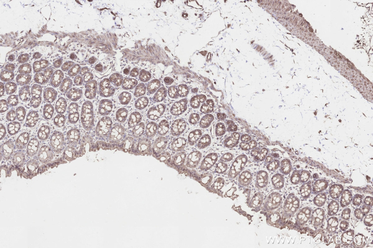 IHC staining of rat colon using 26017-1-AP Immunohistochemistry (IHC) staining of rat colon tissue using KIAA0090 Polyclonal antibody (26017-1-AP)