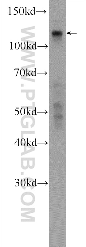 Western Blot (WB) analysis of HeLa cells using KIAA0090 Polyclonal antibody (26017-1-AP)