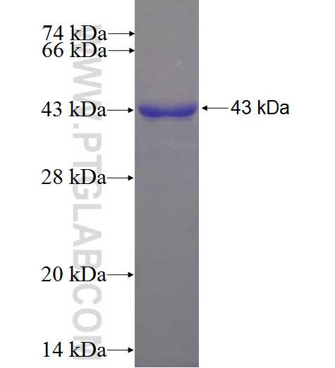 KIAA0090 fusion protein Ag23406 SDS-PAGE