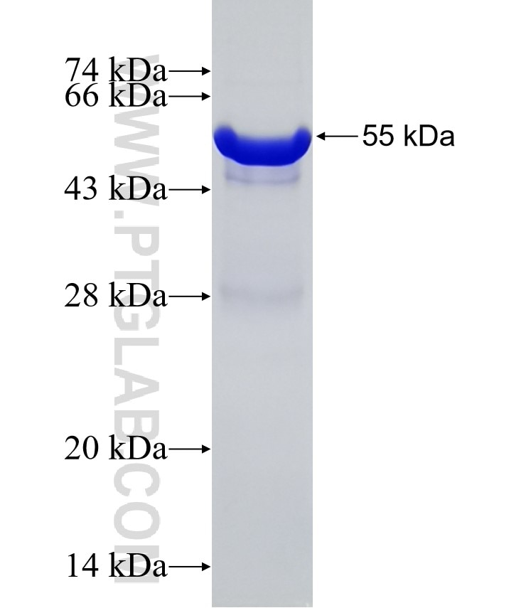 KIAA0090 fusion protein Ag31377 SDS-PAGE