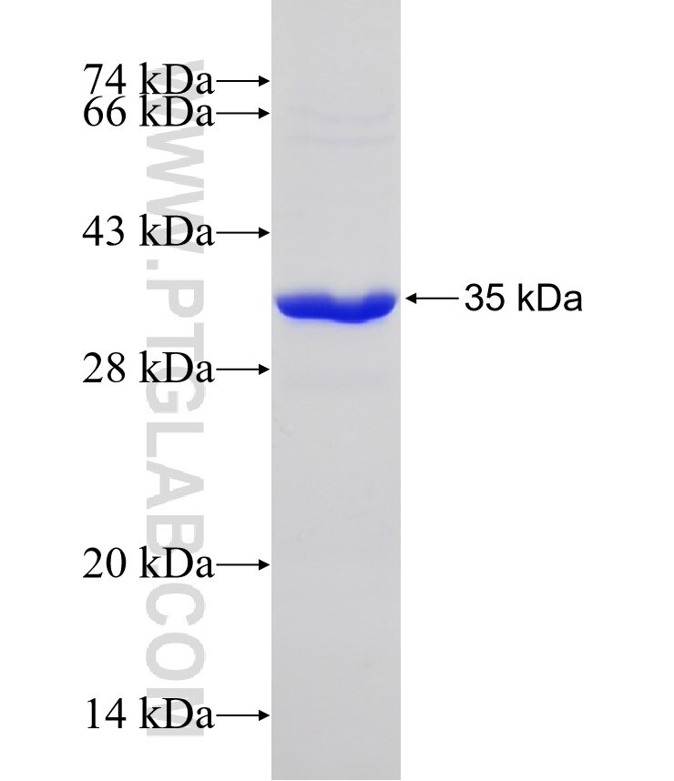 KIAA0090 fusion protein Ag31389 SDS-PAGE