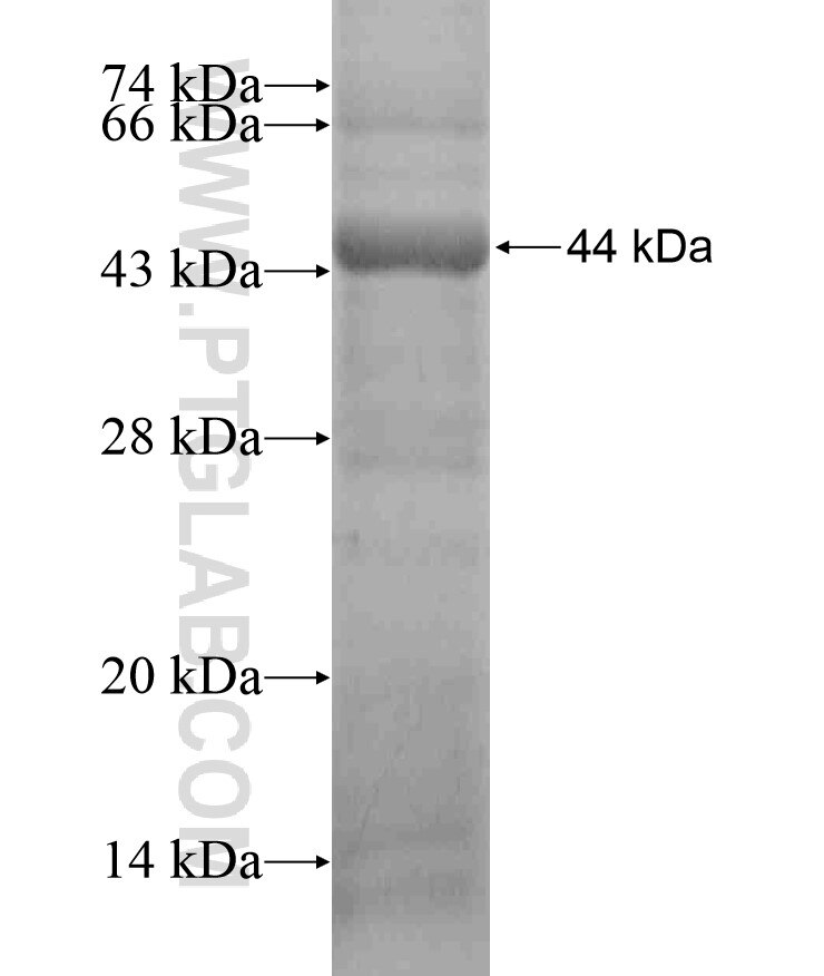 KIAA0100 fusion protein Ag17261 SDS-PAGE