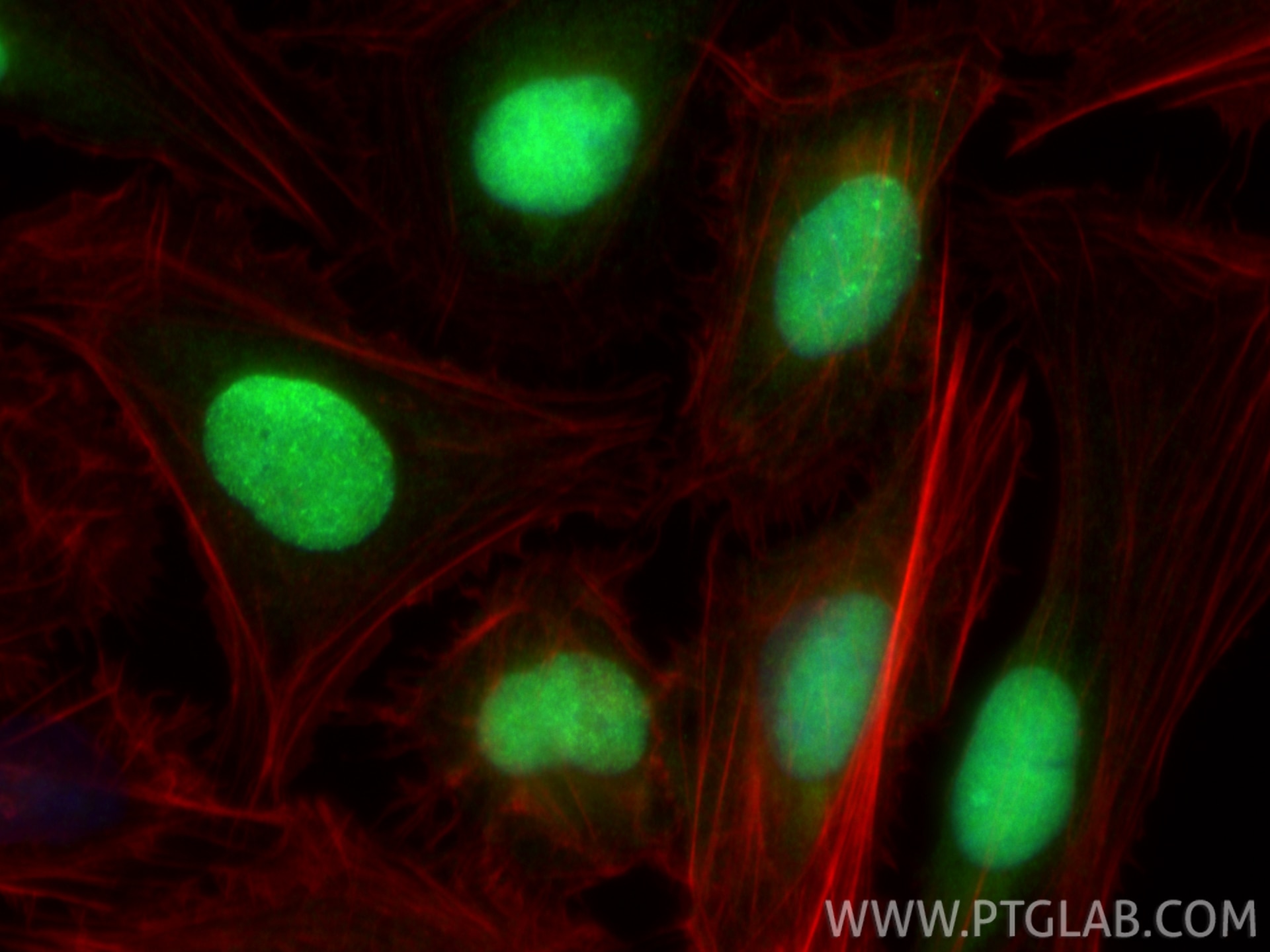 IF Staining of U2OS using 20537-1-AP Immunofluorescence (IF) / fluorescent staining of U2OS cells using PAF15 Polyclonal antibody (20537-1-AP)