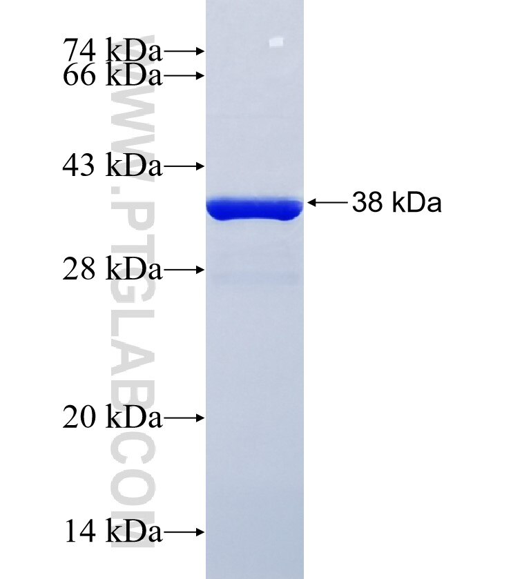 KIAA0101 fusion protein Ag34887 SDS-PAGE KIAA0101 fusion protein Ag34887 SDS-PAGE
