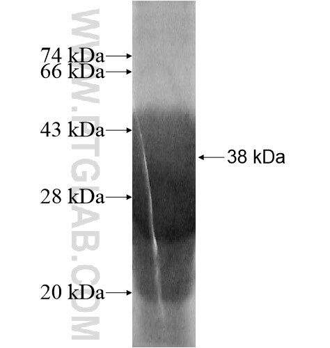 KIAA0101 fusion protein Ag14522 SDS-PAGE