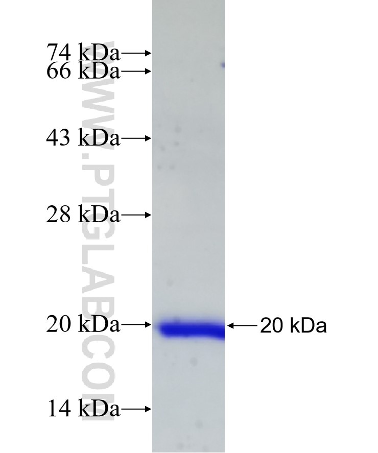 KIAA0101 fusion protein Ag14734 SDS-PAGE