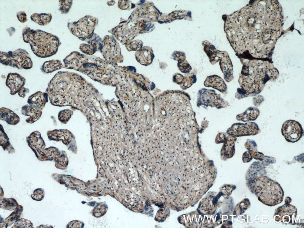 IHC staining of human placenta using 25195-1-AP