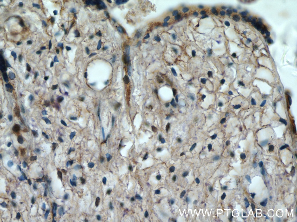 Immunohistochemistry (IHC) staining of human placenta tissue using KIAA0125 Polyclonal antibody (25195-1-AP)