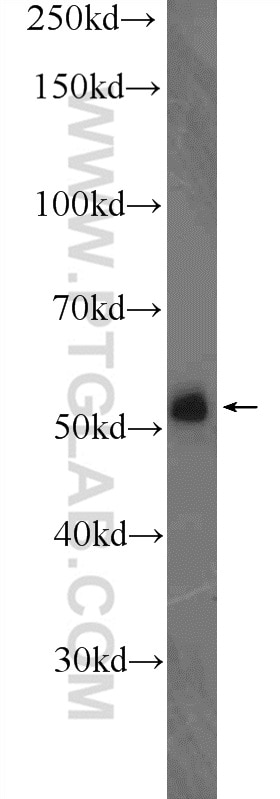 Western Blot (WB) analysis of mouse lung tissue using DELE1 Polyclonal antibody (21904-1-AP)
