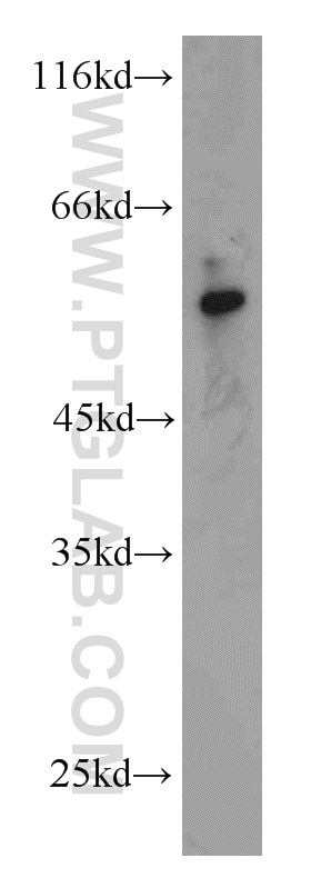 Western Blot (WB) analysis of mouse lung tissue using DELE1 Polyclonal antibody (21904-1-AP)