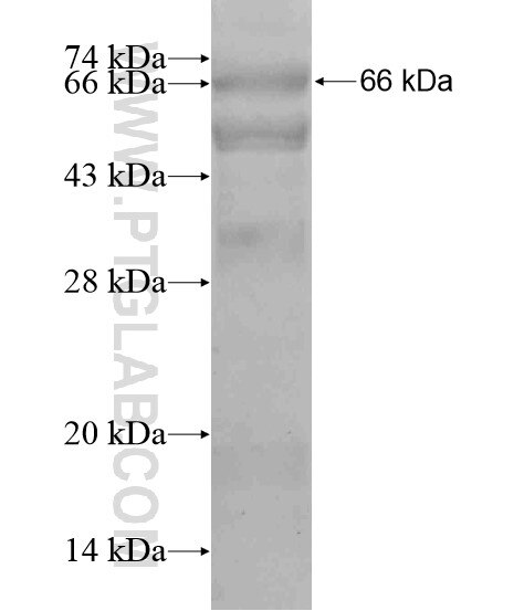 KIAA0146 fusion protein Ag20328 SDS-PAGE