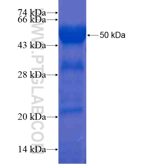 KIAA0146 fusion protein Ag20343 SDS-PAGE