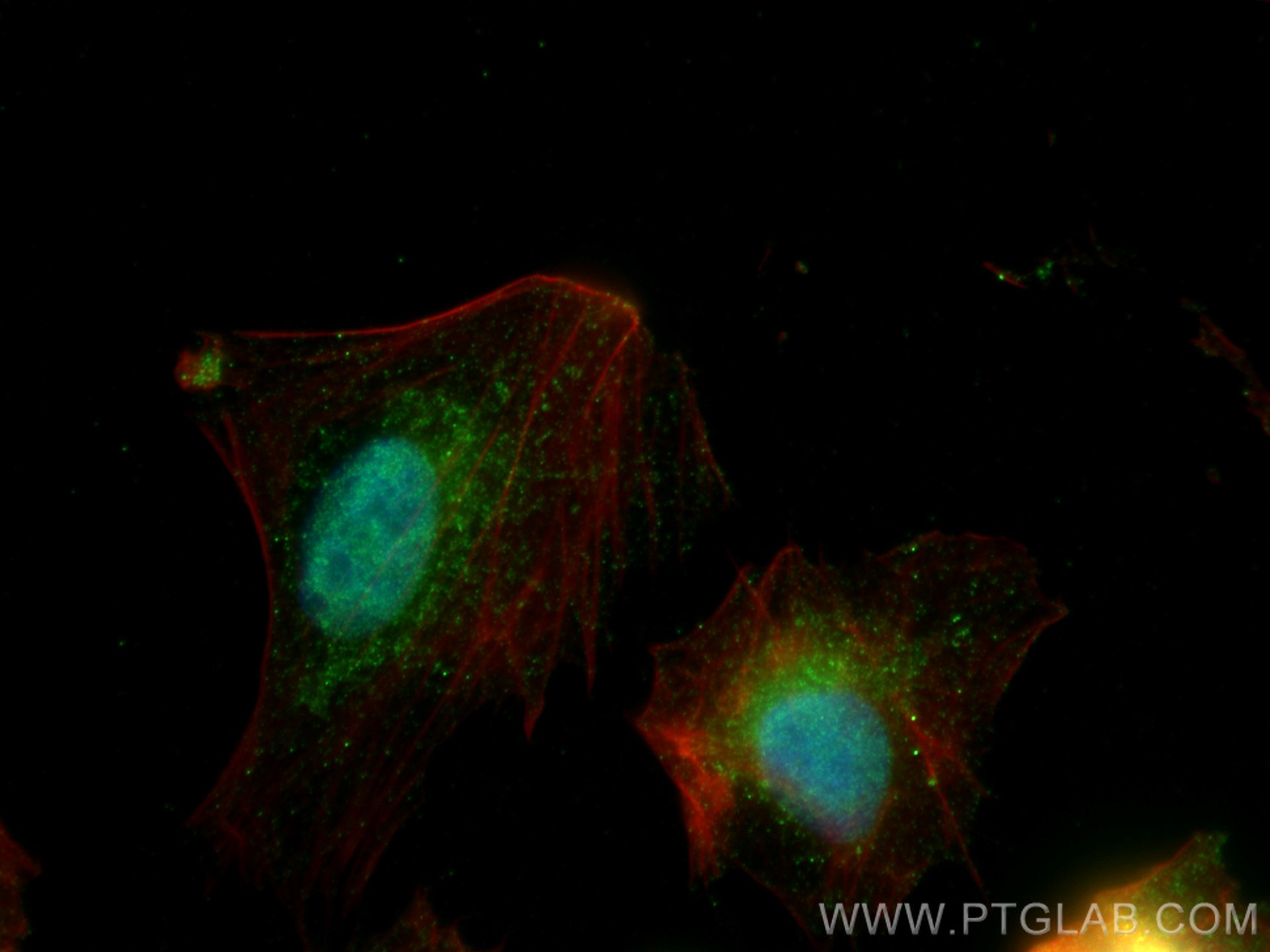 Immunofluorescence (IF) / fluorescent staining of U2OS cells using KIAA0182 Polyclonal antibody (24947-1-AP)