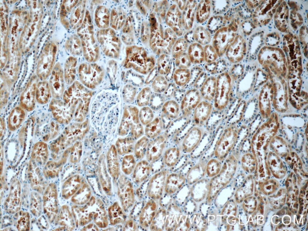 KIAA0182