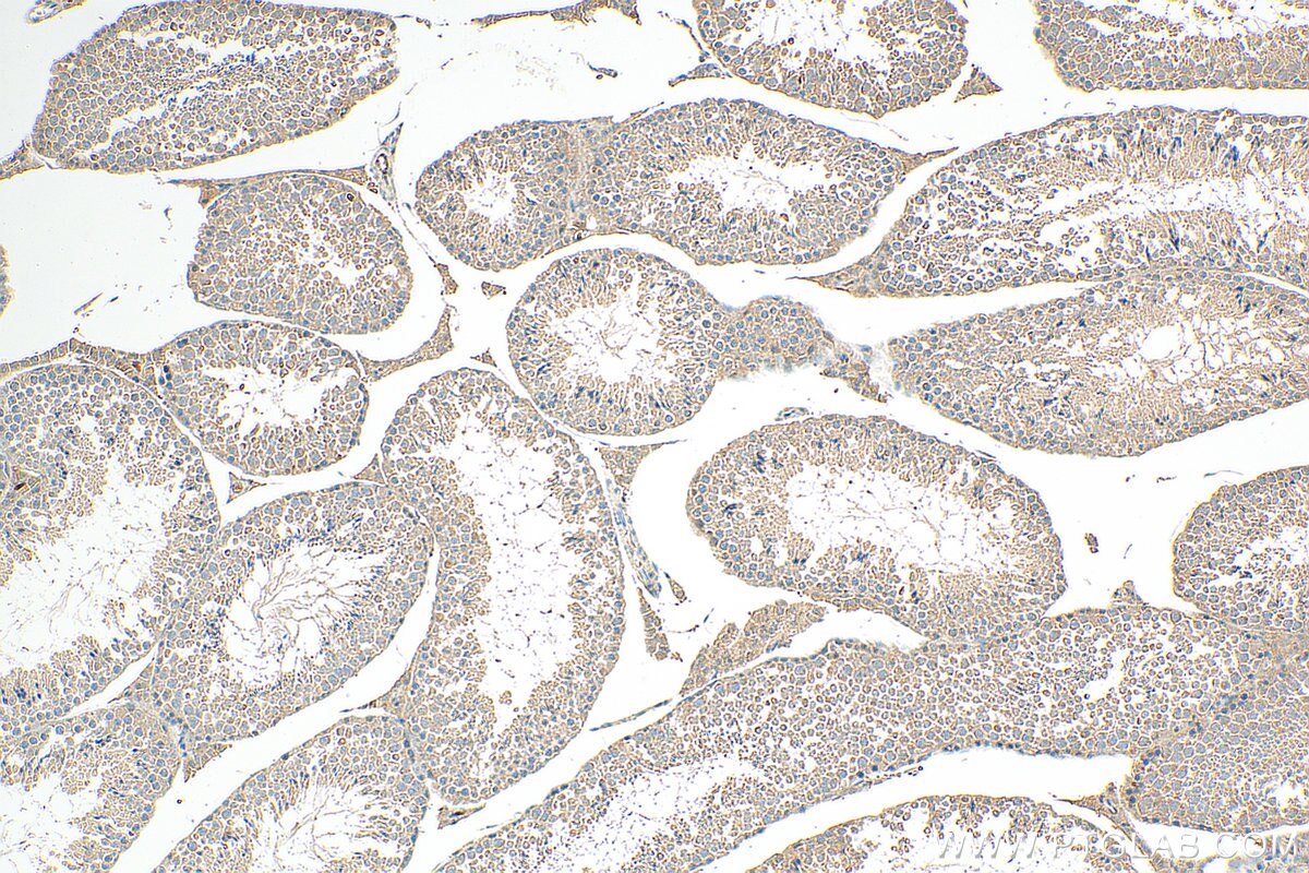 IHC staining of mouse testis using 24947-1-AP