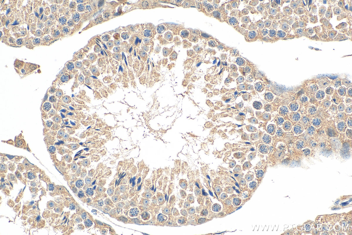 Immunohistochemistry (IHC) staining of mouse testis tissue using KIAA0182 Polyclonal antibody (24947-1-AP)