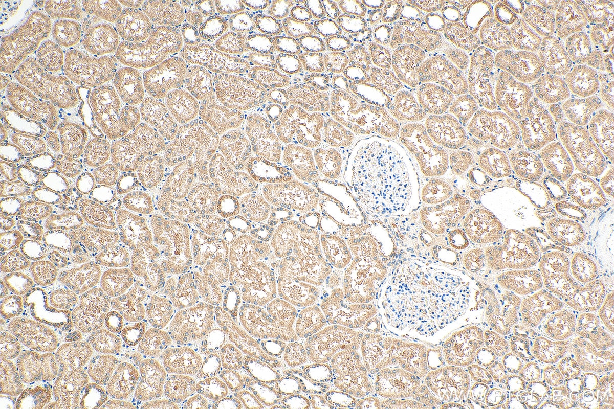 Immunohistochemistry (IHC) staining of human kidney tissue using KIAA0182 Polyclonal antibody (24947-1-AP)