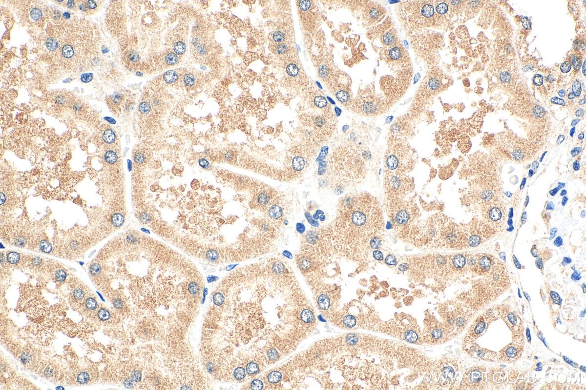 Immunohistochemistry (IHC) staining of human kidney tissue using KIAA0182 Polyclonal antibody (24947-1-AP)