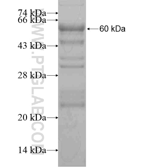 KIAA0182 fusion protein Ag20674 SDS-PAGE