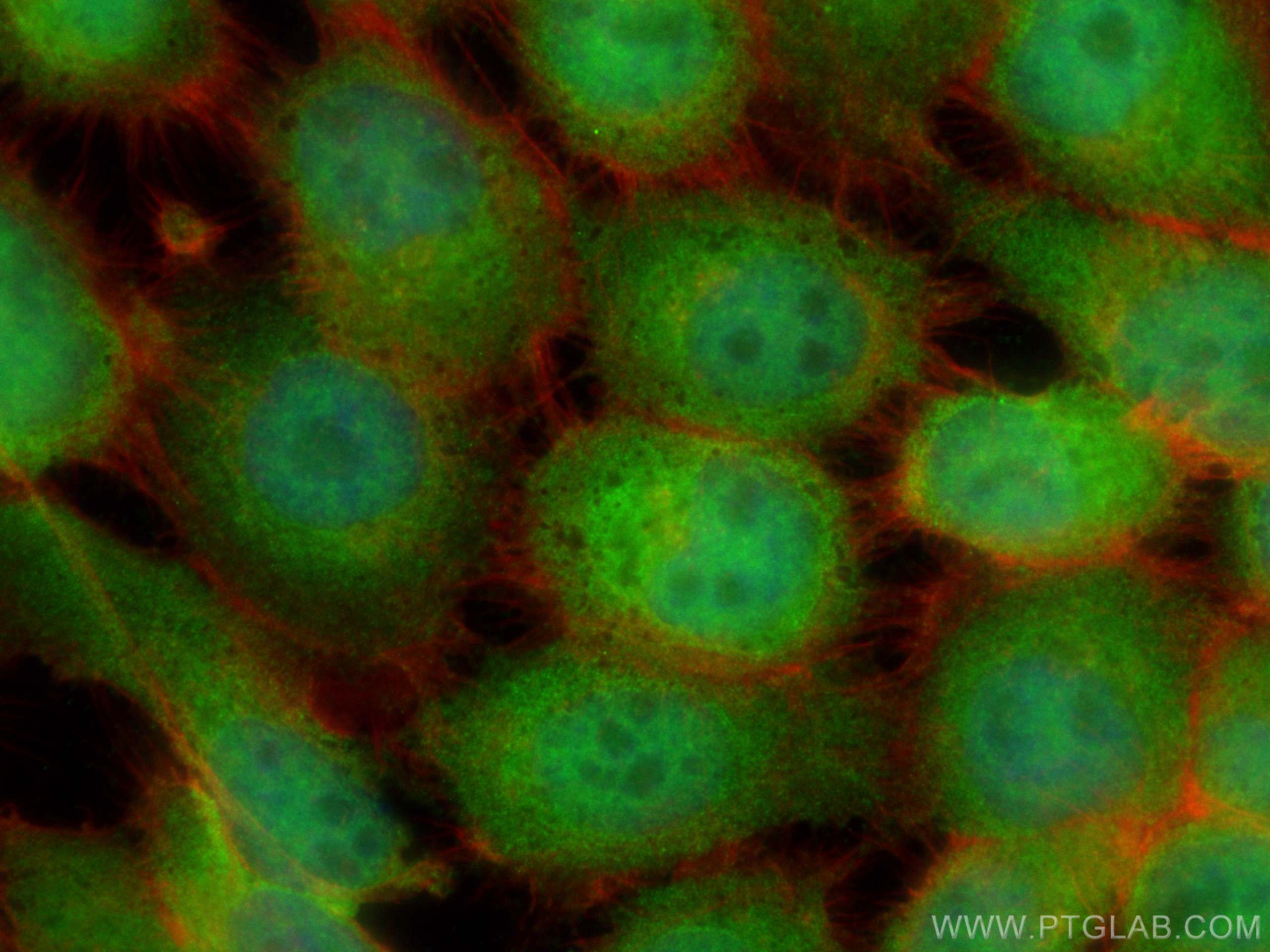 Immunofluorescence (IF) / fluorescent staining of A431 cells using Rubicon Polyclonal antibody (21444-1-AP)