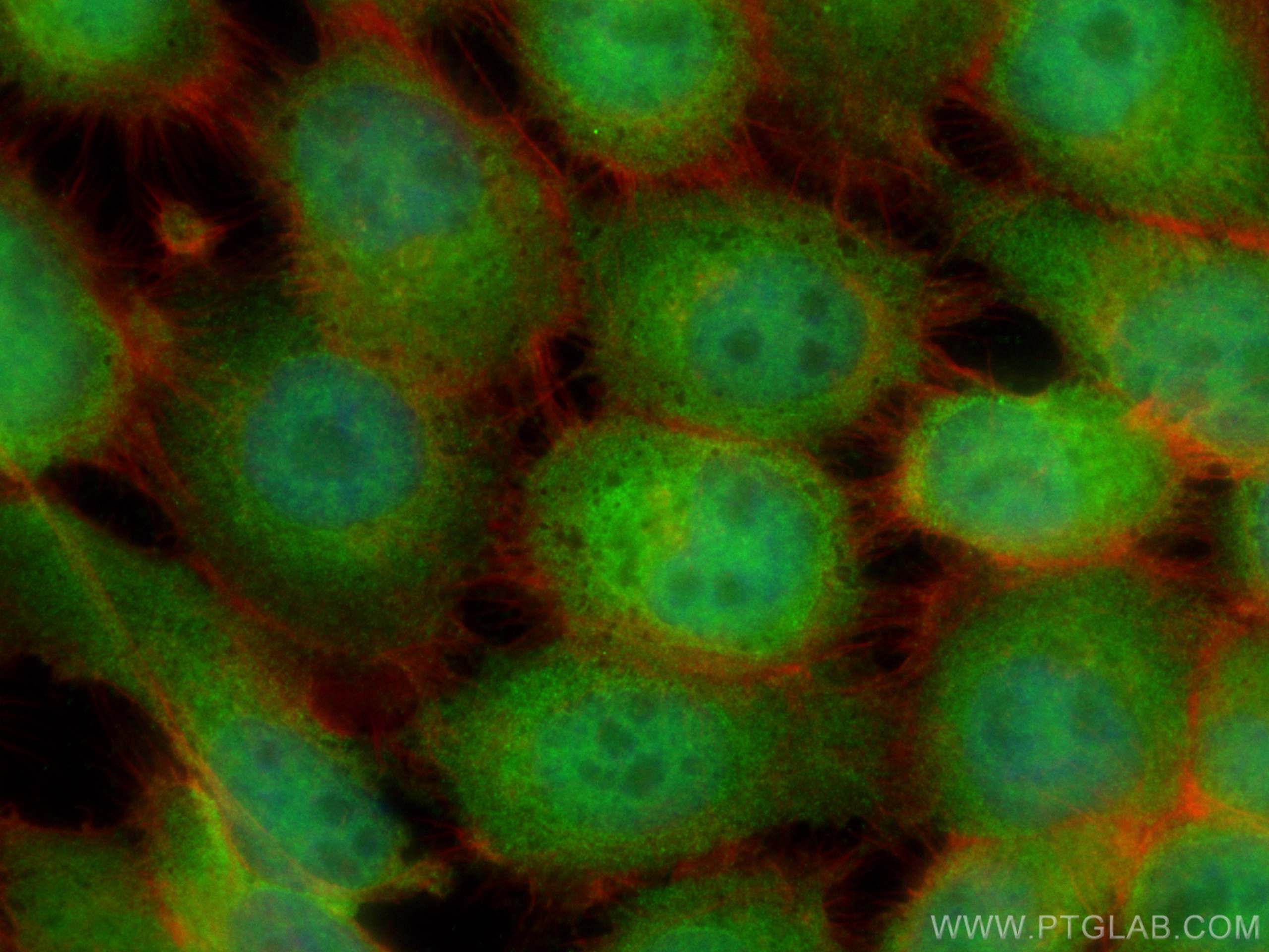 IF Staining of A431 using 21444-1-AP