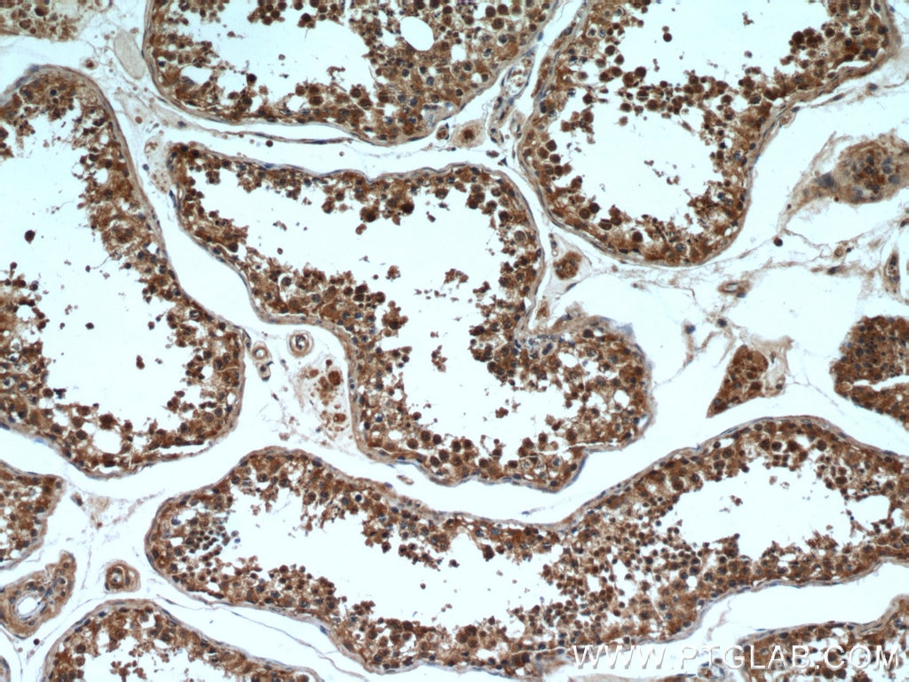 IHC staining of human testis using 21444-1-AP