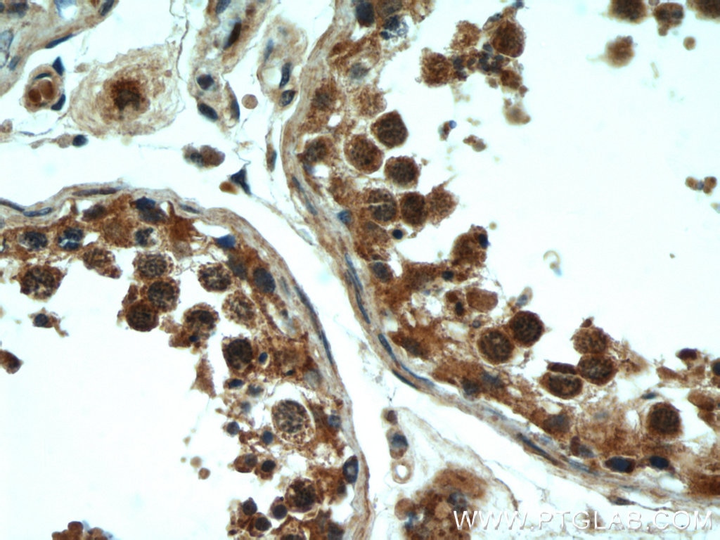 Immunohistochemistry (IHC) staining of human testis tissue using Rubicon Polyclonal antibody (21444-1-AP)