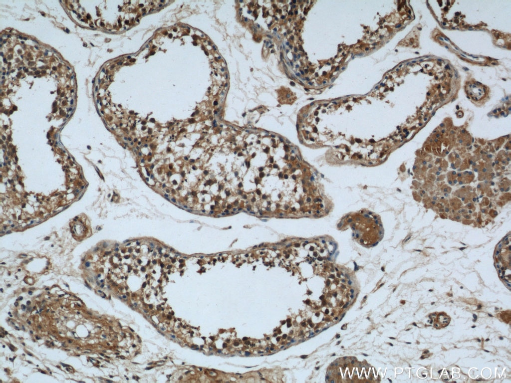 Immunohistochemistry (IHC) staining of human testis tissue using Rubicon Polyclonal antibody (21444-1-AP)