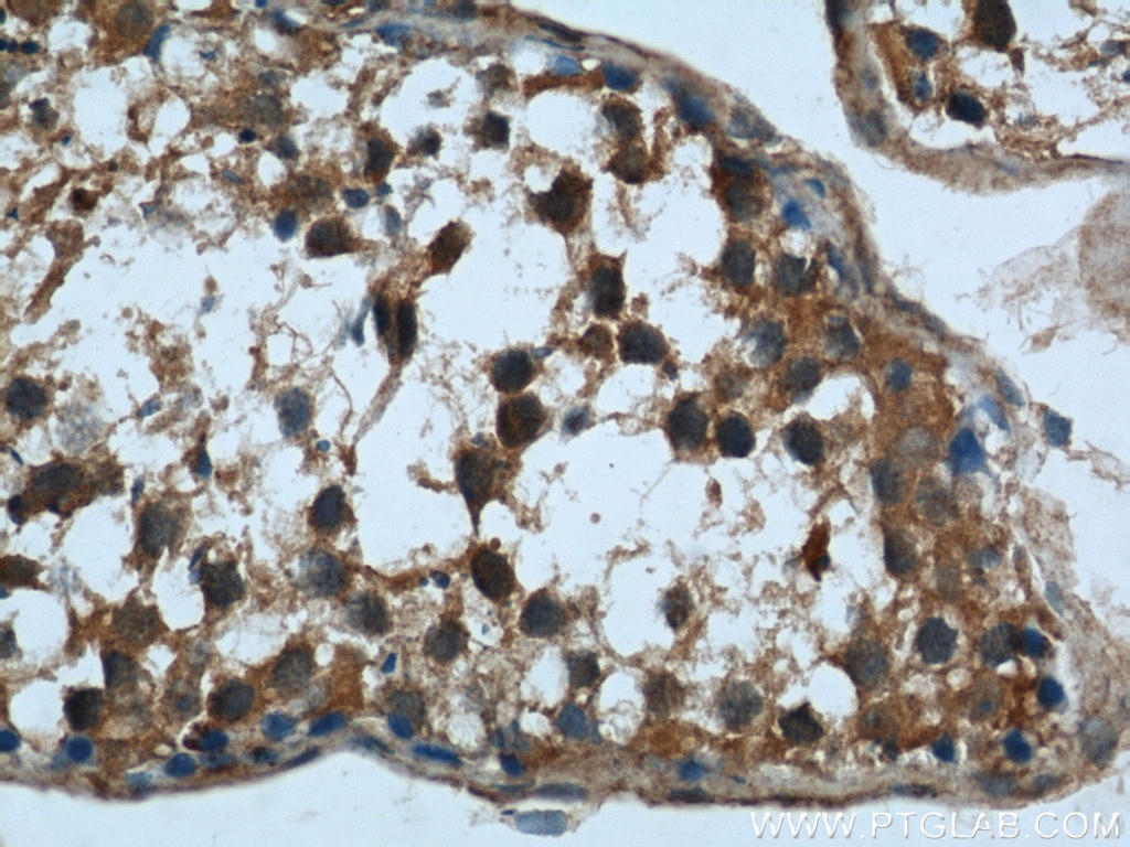 Immunohistochemistry (IHC) staining of human testis tissue using Rubicon Polyclonal antibody (21444-1-AP)