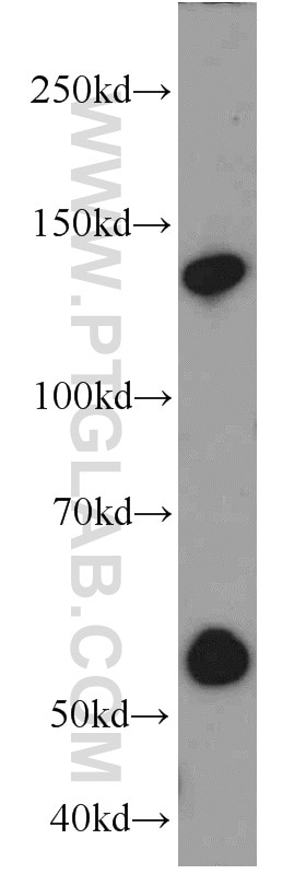 Western Blot (WB) analysis of mouse liver tissue using Rubicon Polyclonal antibody (21444-1-AP)