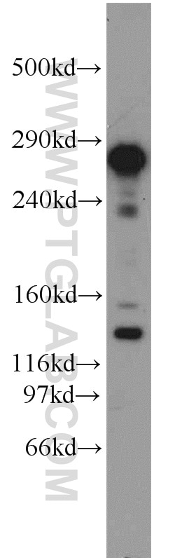 Western Blot (WB) analysis of HeLa cells using Rubicon Polyclonal antibody (21444-1-AP)
