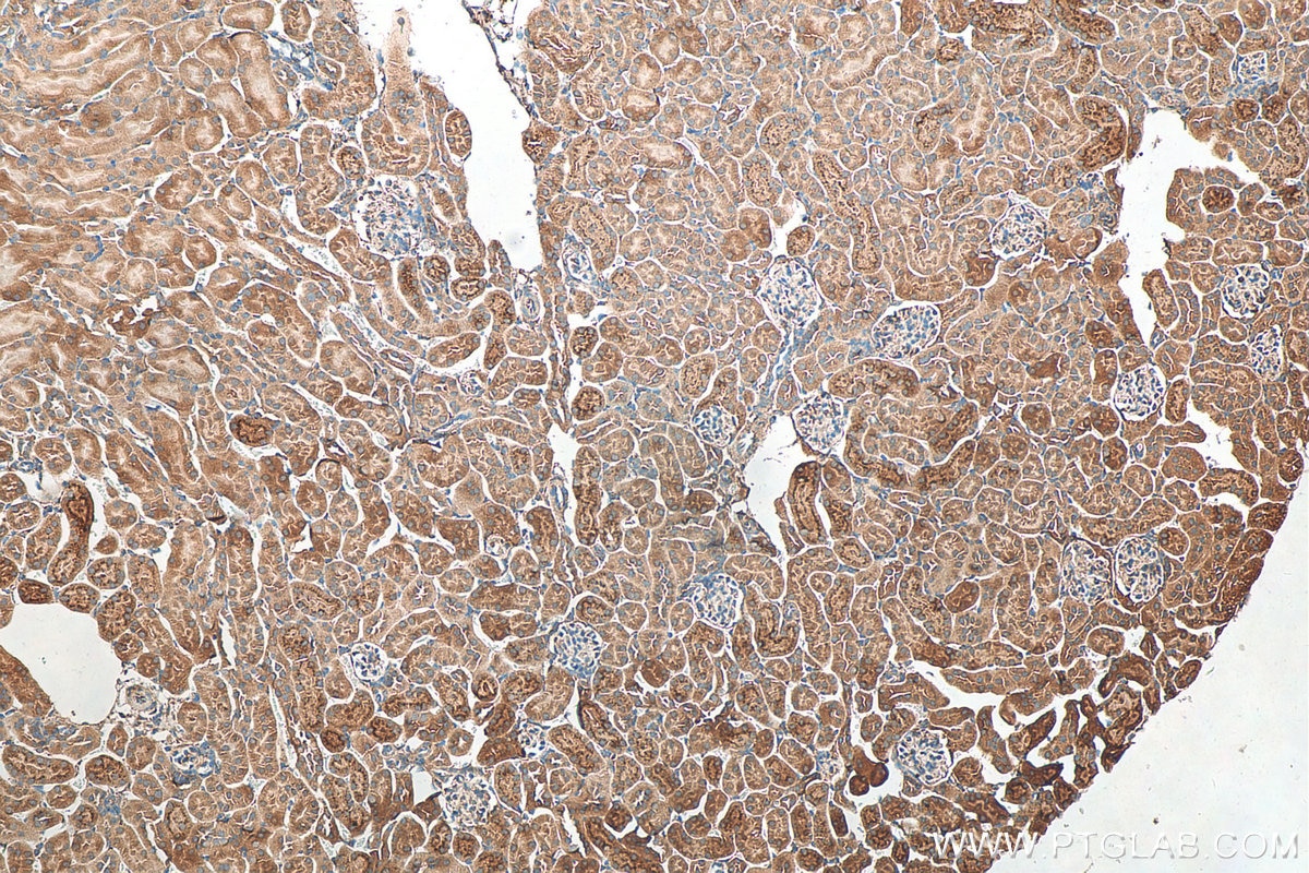Immunohistochemistry (IHC) staining of mouse kidney tissue using KIAA0317 Polyclonal antibody (25623-1-AP)