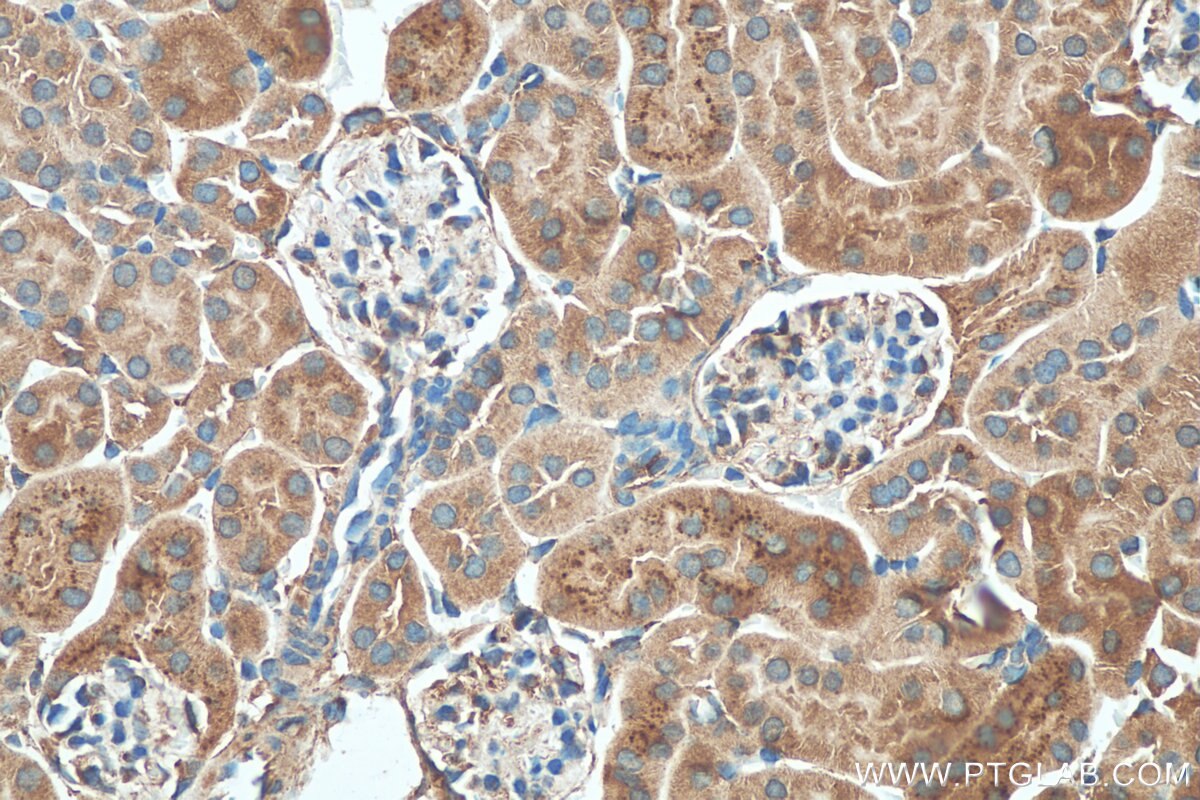 Immunohistochemistry (IHC) staining of mouse kidney tissue using KIAA0317 Polyclonal antibody (25623-1-AP)