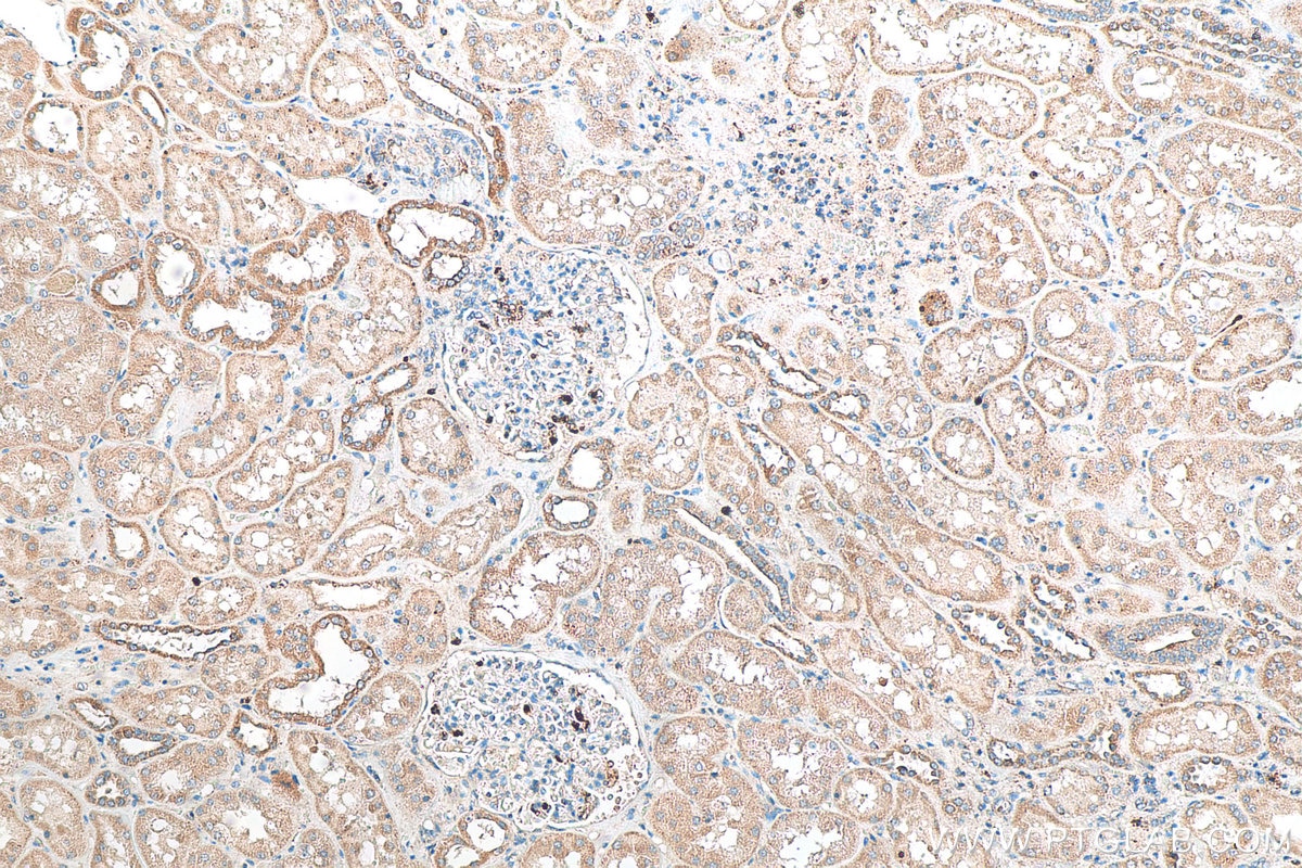 Immunohistochemistry (IHC) staining of human kidney tissue using KIAA0317 Polyclonal antibody (25623-1-AP)