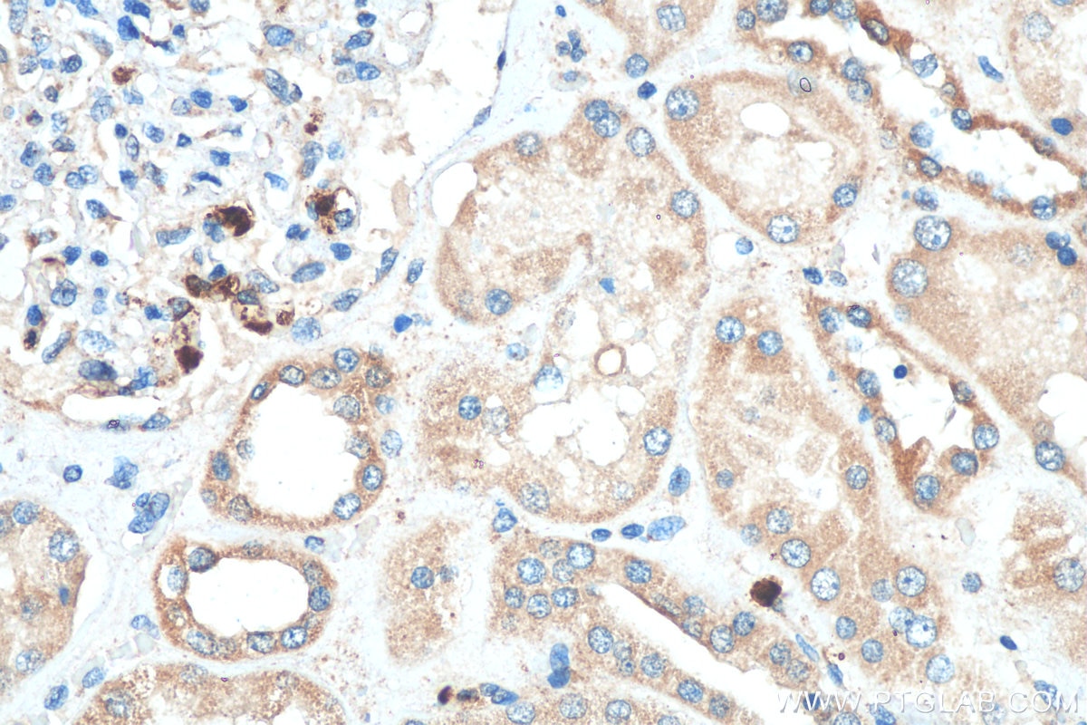 Immunohistochemistry (IHC) staining of human kidney tissue using KIAA0317 Polyclonal antibody (25623-1-AP)