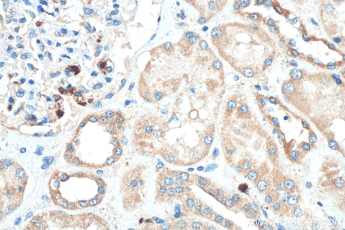 Immunohistochemistry (IHC) staining of human kidney tissue using KIAA0317 Polyclonal antibody (25623-1-AP)
