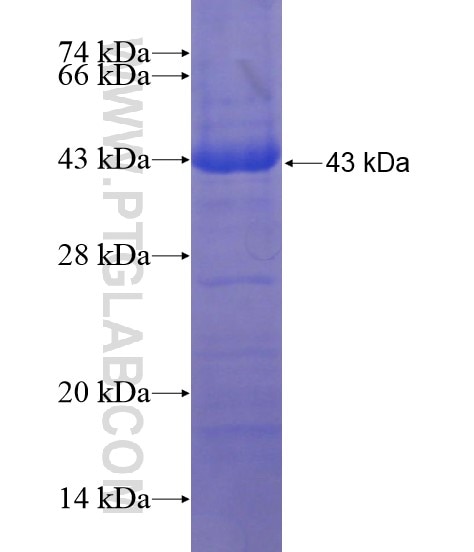 KIAA0317 fusion protein Ag19906 SDS-PAGE