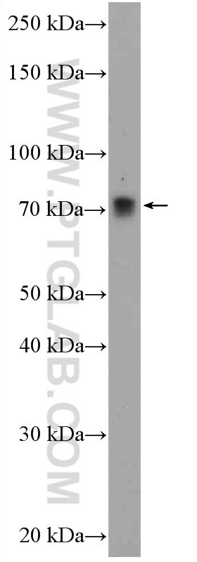 Western Blot (WB) analysis of mouse brain tissue using KIAA0319 Polyclonal antibody (21927-1-AP)